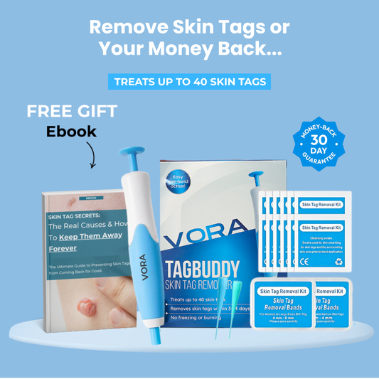 MyTaggymate – No More Skin Tags